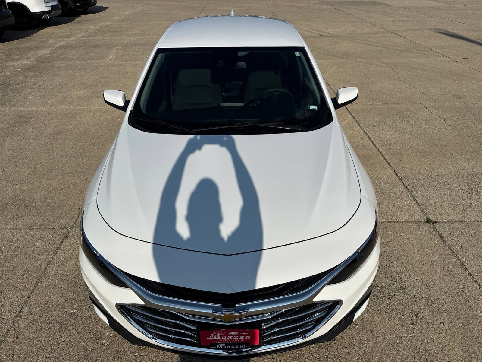 2025 Chevrolet Malibu 1LT